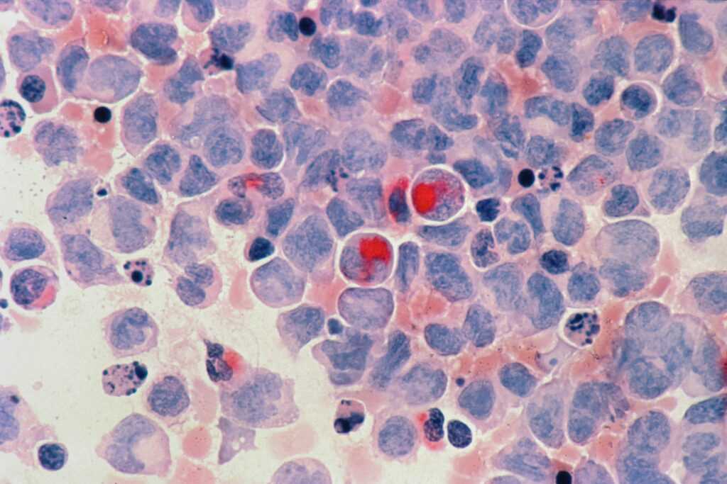 national cancer institute mbL91Lg56zc unsplash